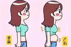 「六盘水市妇幼保健院健康科普」 腹直肌分离怎么办？图片