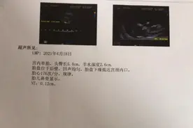 怀孕回忆录：产检图片