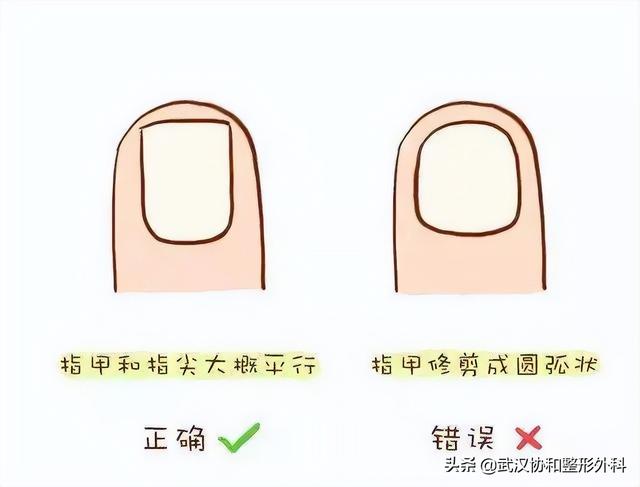 足底过度角化名词解释