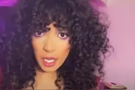 女子与男友接吻后惨变“香肠嘴”，得知原因哭笑不得：严重过敏图片