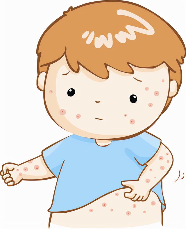 两颊毛囊角化症