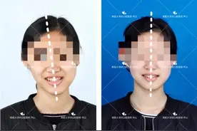 高考首日，深圳这家口腔医院笑着解出了最后“大题”：看牙难图片