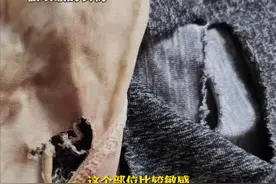 无妄之灾！未婚女子夜跑时被恶犬咬伤隐私部位，“留下的疤痕对我未来会有一定影响”图片
