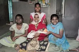 印度女子产下八肢婴儿，网友：这是神的降临图片