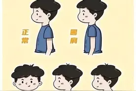 驼背、探颈、侧弯几招改善儿童的这些体态图片