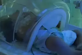 11年前，四川夫妇生下中国首例“双头胎儿”，将医院告上法庭……图片