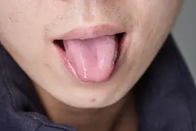 几块钱一瓶的维生素B2，是高血压的“克星”？很多人太晚知道图片