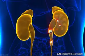 肾结石？分享3味中药，助你排石、通淋、利尿图片