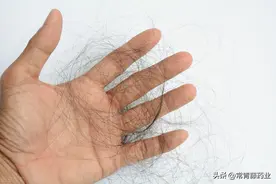 你的头发逐渐在变细软？小心潜在的脱发问题，一文了解清楚图片