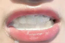 牙黄、牙渍真的刷掉了！过来人教你三招，不出一月牙齿亮白如新图片