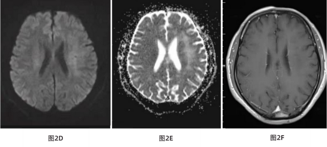 额头上鸡皮肤图片大全