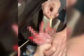 有毒！靖江一小男孩在景观池边玩水，被一条“怪鱼”咬伤图片