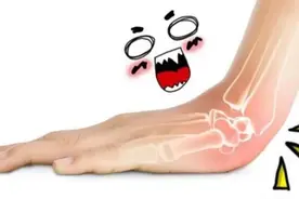 骨折吃什么快速恢复？图片