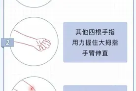 快来自测一下 你的手“病”了吗图片
