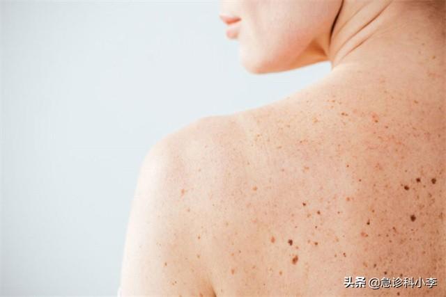 手上长了很多小红点