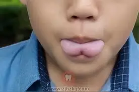 【哈医大一院爱牙日系列科普】口腔健康小知识（二）图片