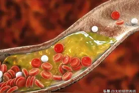 血脂高怎么吃？降血脂的食谱来了！图片