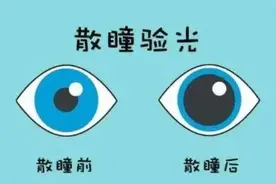 散瞳后多久恢复？散瞳后注意事项｜视百年眼科图片