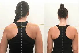 高低肩是如何引起的？又该如何纠正训练图片