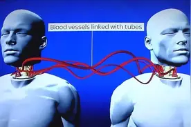 生物学中研究的“换头技术”真的存在吗？图片