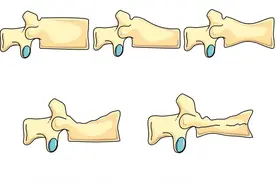CorelDRAW绘图课程 一试就会，带你轻松绘制骨头图片