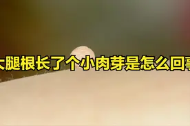 大腿根长了个小肉芽是怎么回事图片