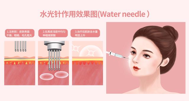 清明小假期来临,有什么适合春季做的医美项目?