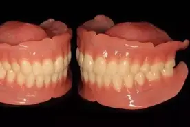 “仿生牙”横空出世，是要取代种植牙吗？专家为你解答图片