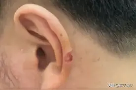 耳朵被剪掉一块肉理发店赔200图片