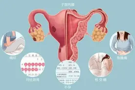 子宫切除后，还能进行夫妻生活吗？这些注意事项一定要了解图片