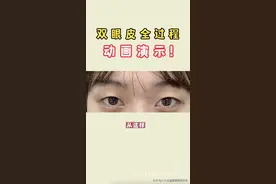 双眼皮全过程，动画演示！图片