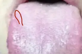 大家好，我是彭英克，今天教给大家通过舌象分辨自己属于体质。图片