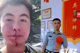 打人路虎女后续：男子重新申请伤情鉴定，一旦轻伤可能会判刑图片