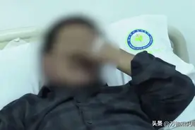 捡“死眼镜蛇”回家吃，蛇头突然“复活”喷毒，男子险些失明图片