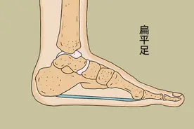 身体有疾，看鞋子能知晓？鞋子出现3种迹象，需放在心上图片