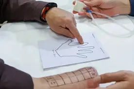 热！截肢后也能感知温度图片