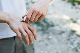 “红霉素软膏”不仅价格低廉，生活中还有这6大妙用，不妨看看！图片