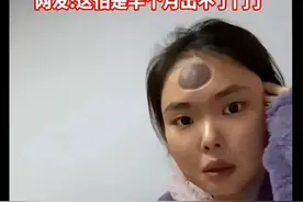 搞笑，女儿头痛难忍妈妈给女儿拔火罐治疗，女儿照镜子后都快哭了图片