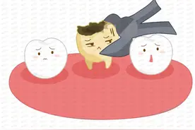 拔牙后的这5件事，一定要重视图片
