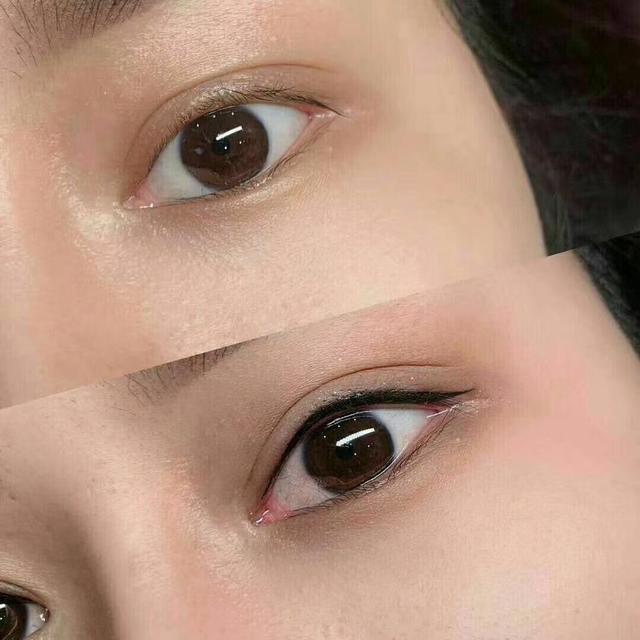 纹美瞳线后注意事项