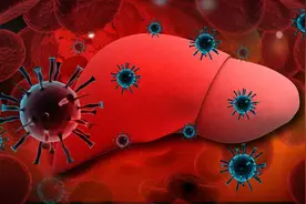 提醒乙肝患者：日常若不注意这3点，当心疾病发展成肝硬化！图片