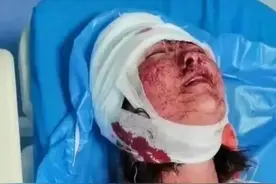 不光打人，还要讹钱？唐山陈继志有够阴险，打完人后叫120就医图片