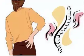 腰椎间盘突出的典型6大症状，6种预防办法，一套简单腰背肌锻炼操图片