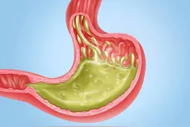 从“胃炎”到胃癌，大概需要几年？消化科医生解答，看完涨知识了图片