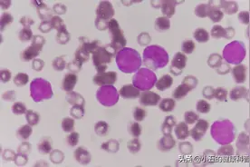 老年人出现白细胞减少怎么办？科学服用5种药物，提高机体免疫力图片