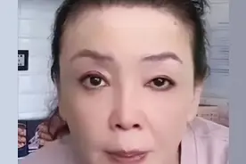 66岁张兰自曝患白癜风！额头脖子突长小白点！自我调侃变“张导”图片