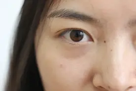 “左眼皮跳跳，好运要来到”，眼皮跳动真的是凶吉的征兆吗？图片