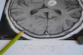 睡觉时经常会被手麻醒，可能不是压到而是疾病？图片