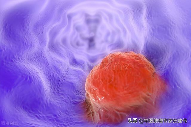 冬季是進補好時節，腫瘤患者如何“補”才對？教你最關鍵的幾點
