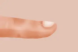 指甲出现4种异常表现，可能是生病了，要及时检查排除癌变图片